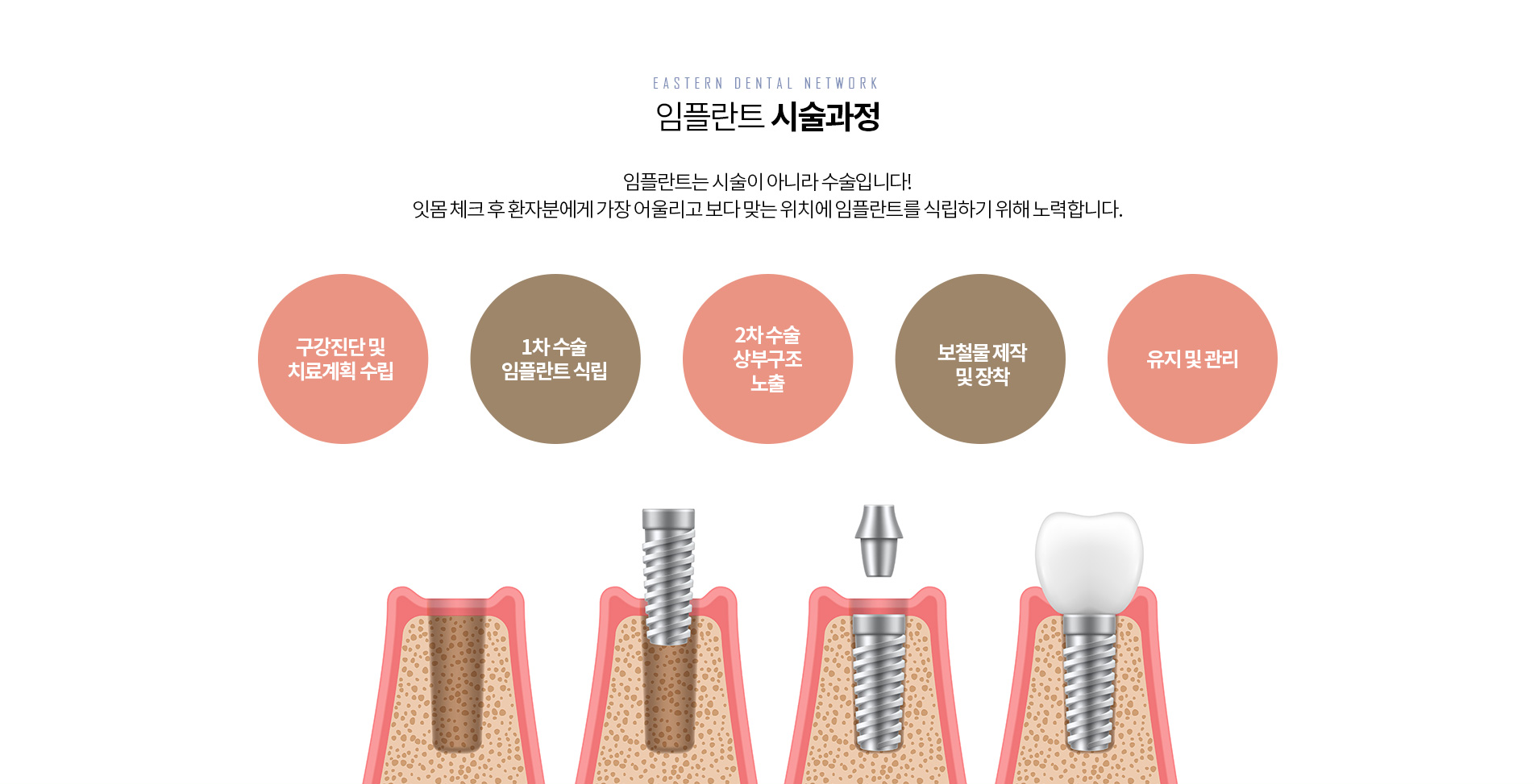 ���ö�Ʈ �ü�����