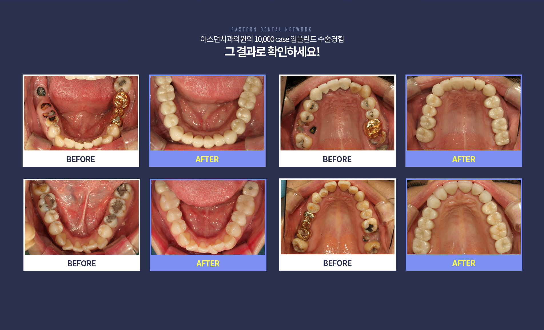 �̽���ġ�� ���ö�Ʈ ����