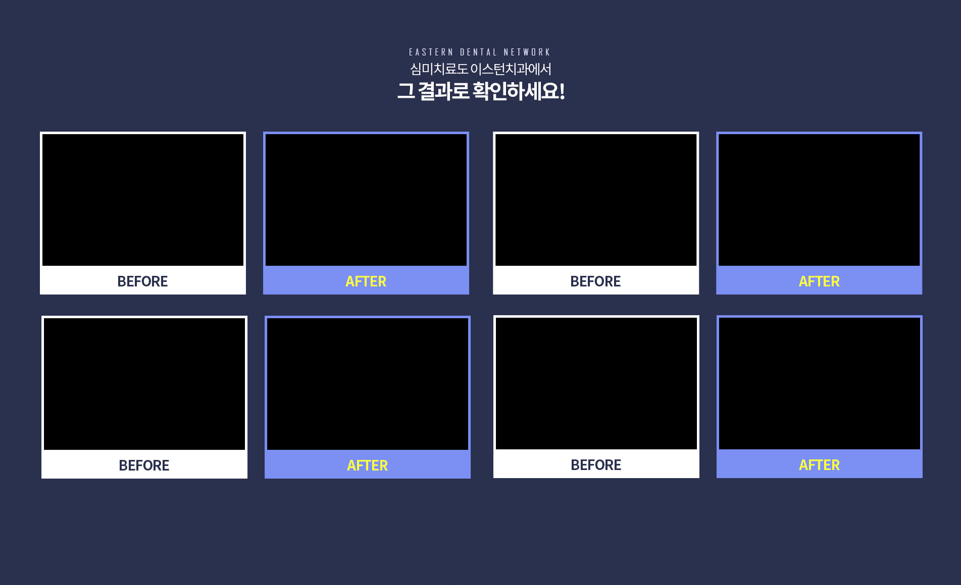 심미치료 전후사진